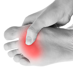 Plantar Fasciitis